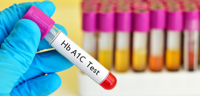 CBC Test and HBA1c Test are Essential Tools for Long-Term Health